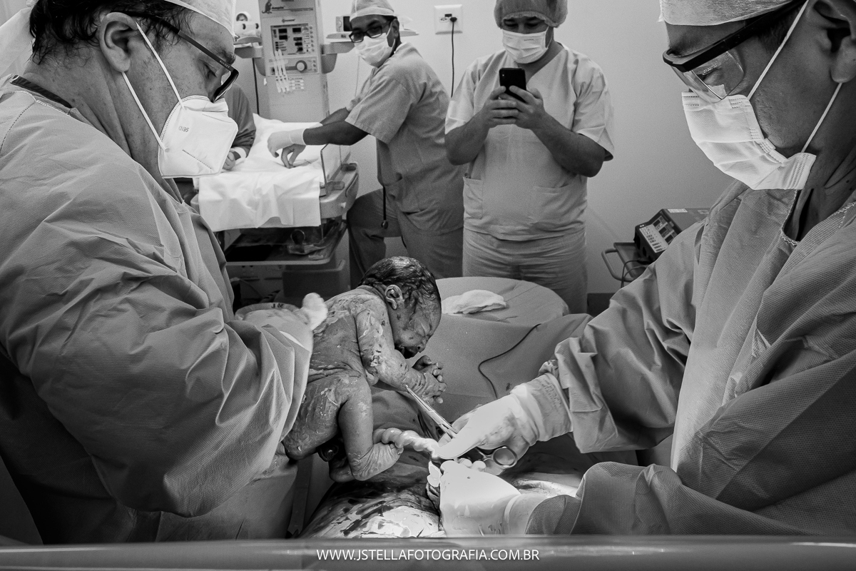 fotografia de parto hospital santa joana